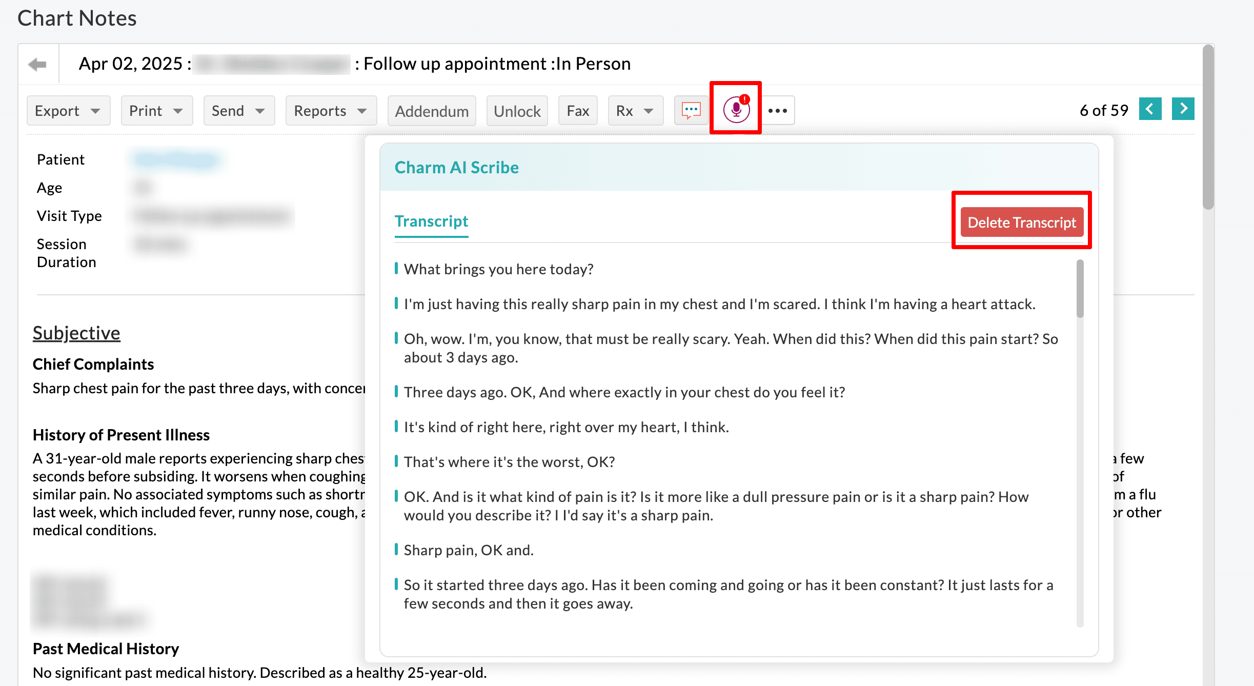 Delete Transcript Button