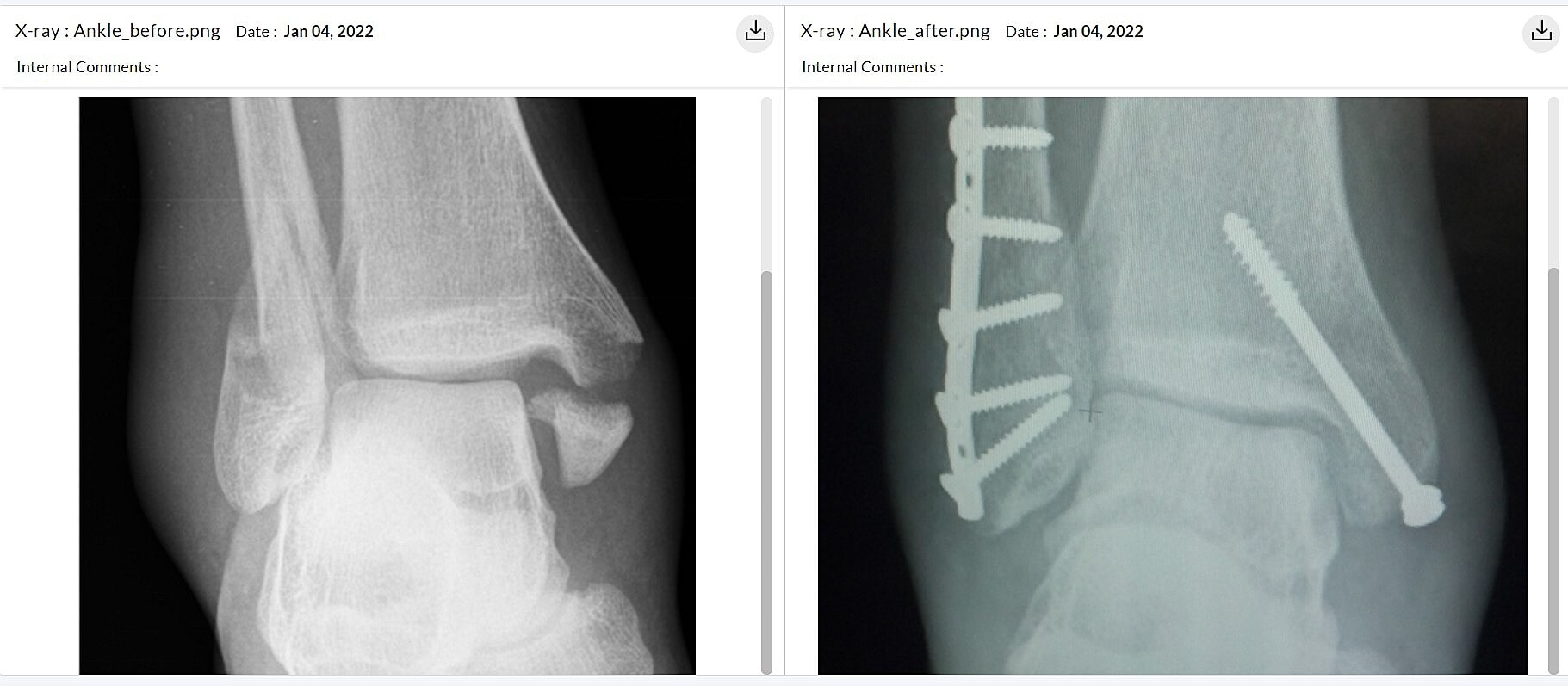 Compare Documents by Side